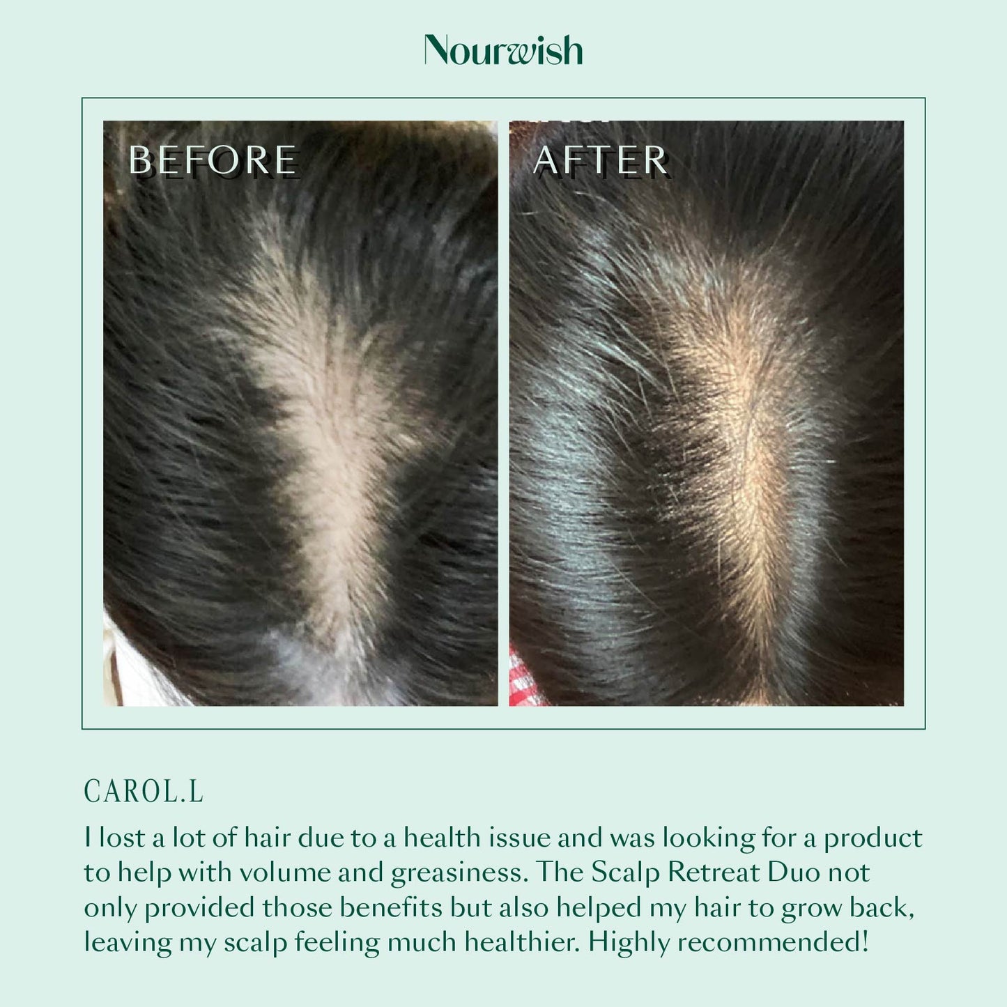 Nourwish Scalp Retreat Regenerating Shampoo (For Oily Scalp)
