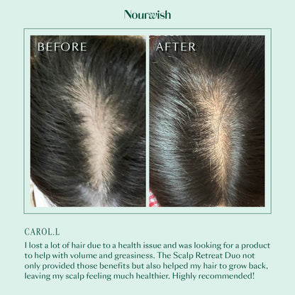 Nourwish Scalp Retreat Regenerating Shampoo (For Oily Scalp)