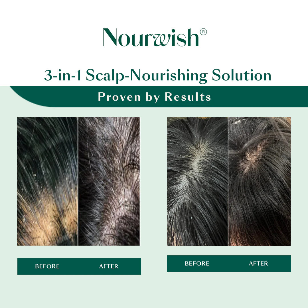 Scalp Retreat Shampoo + Serum Duo