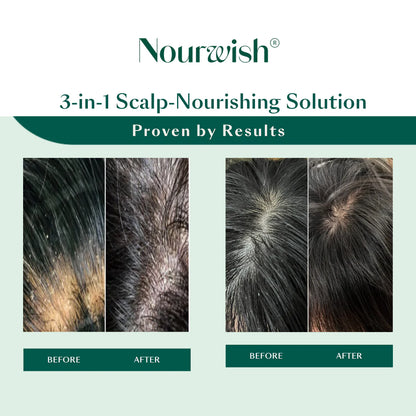 Scalp Retreat Shampoo + Serum Duo